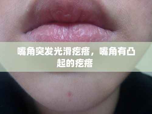 嘴角突发光滑疙瘩，嘴角有凸起的疙瘩 
