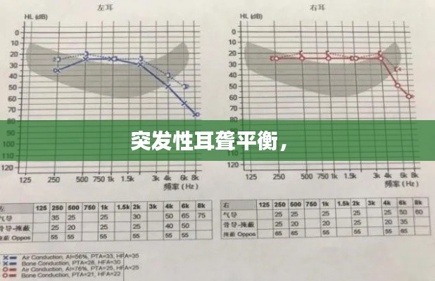 突发性耳聋平衡,
