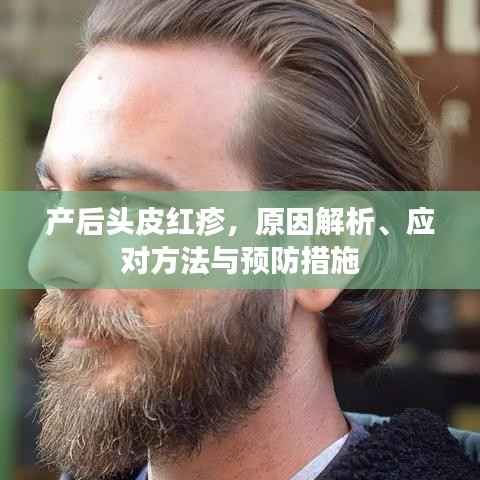 产后头皮红疹，原因解析、应对方法与预防措施