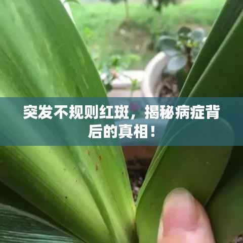 突发不规则红斑，揭秘病症背后的真相！